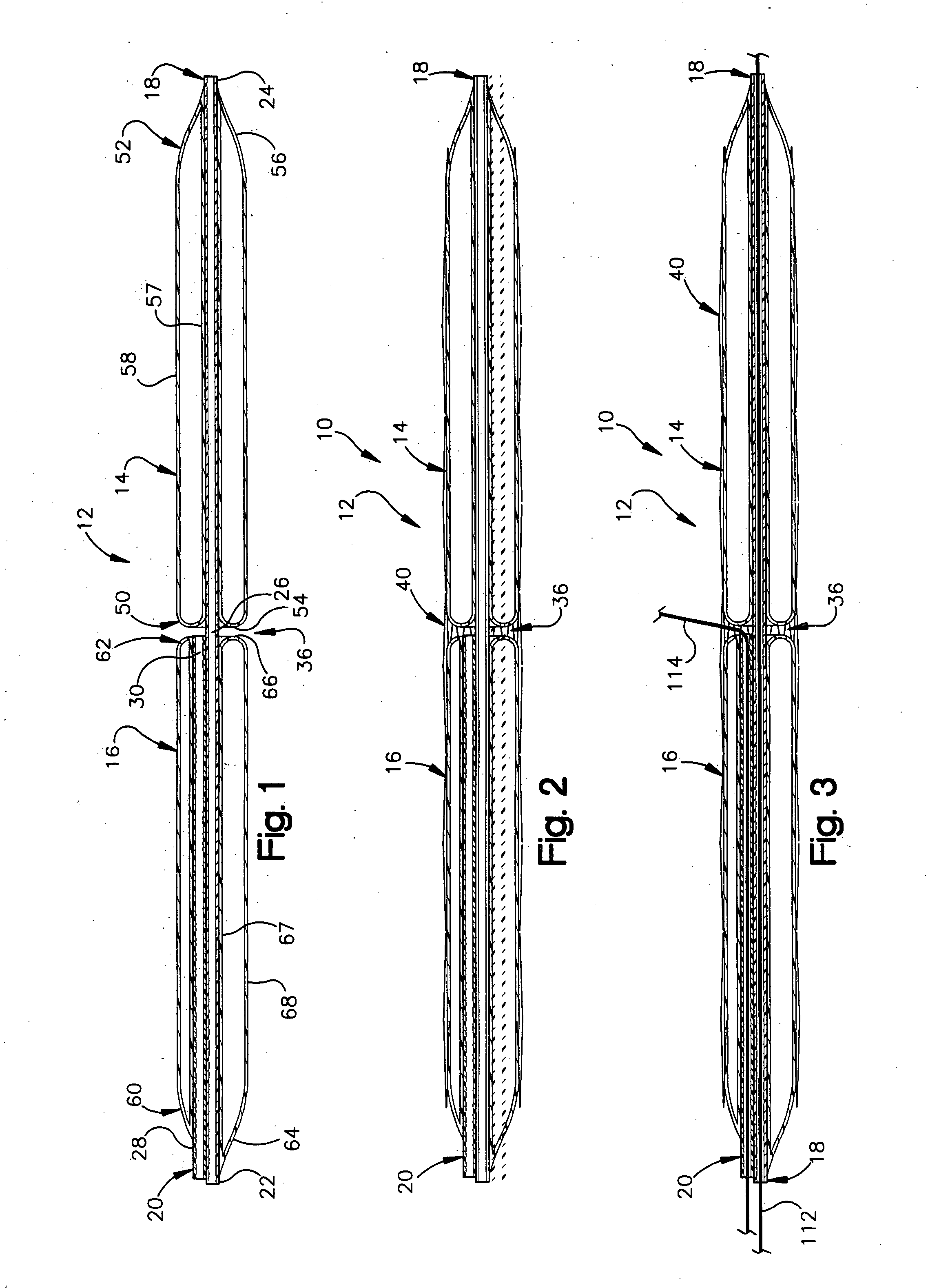 Apparatus for treating atherosclerosis