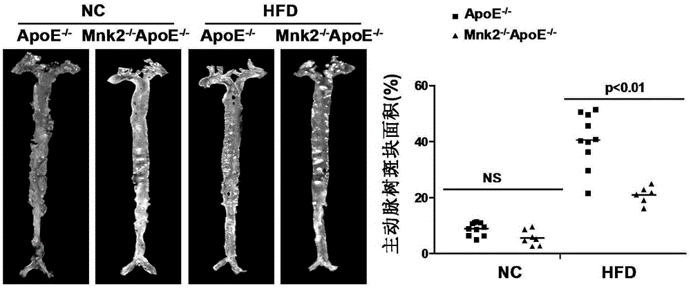 Function and application of MAPK signal-integrating kinase 2 in the treatment of atherosclerosis