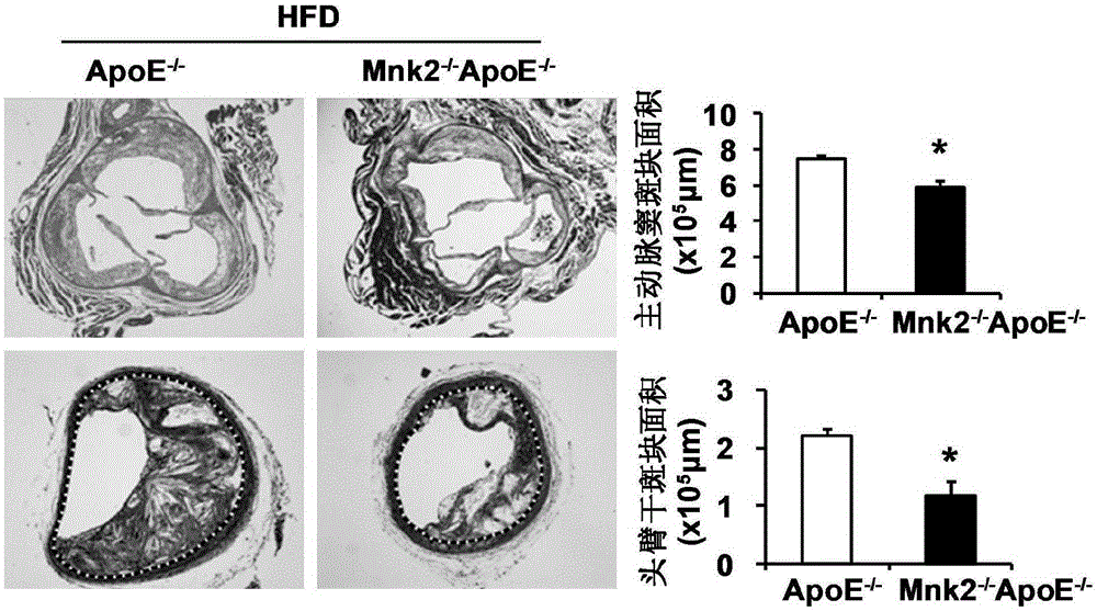 Function and application of MAPK signal-integrating kinase 2 in the treatment of atherosclerosis