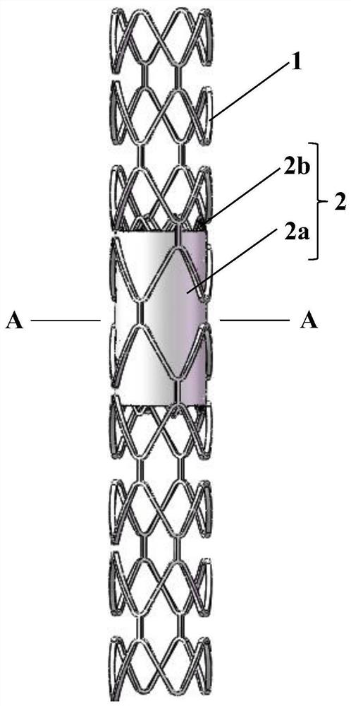 An orderly and completely degradable covered bilayer stent