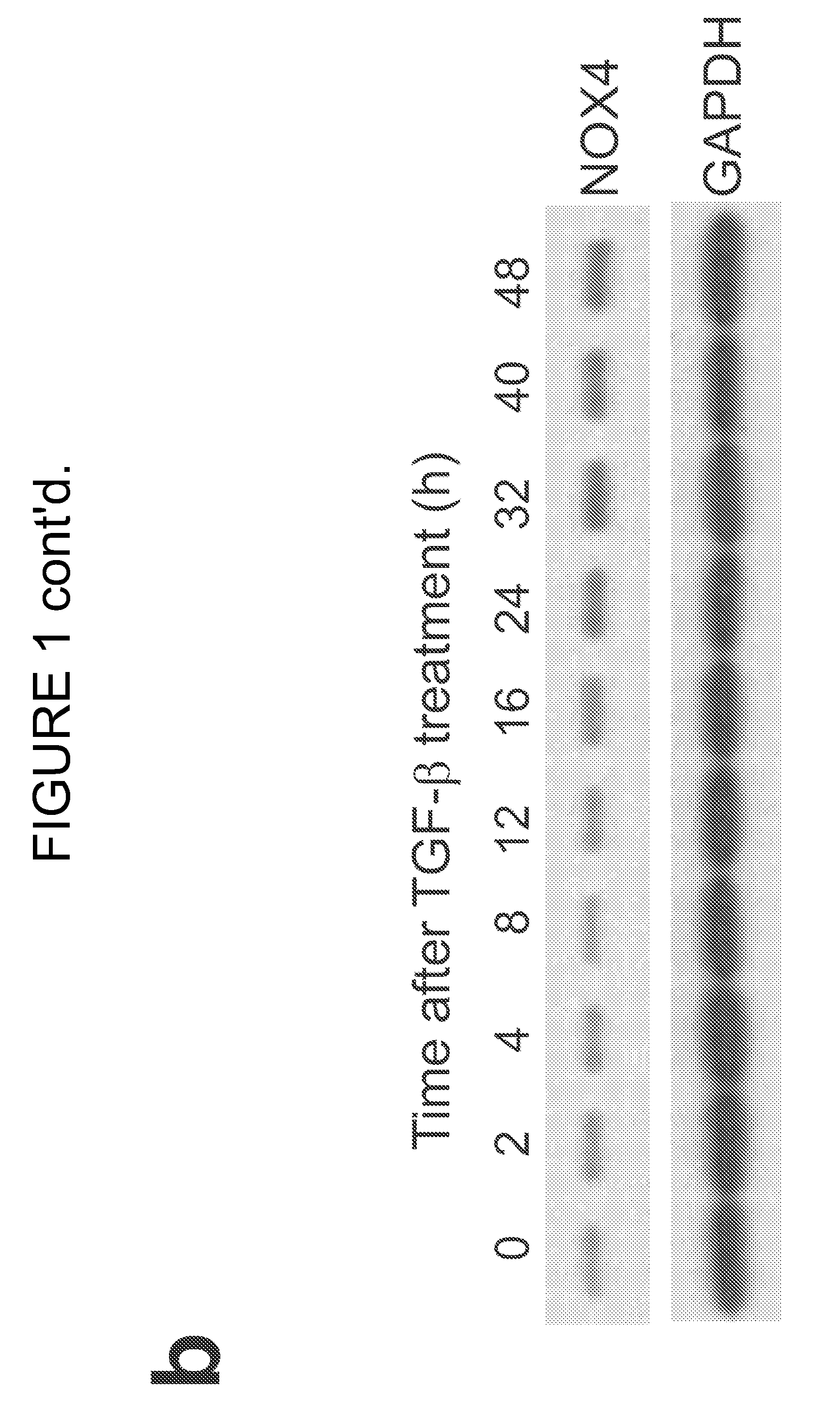 Compositions and methods for diagnosing and treating fibrotic disorders