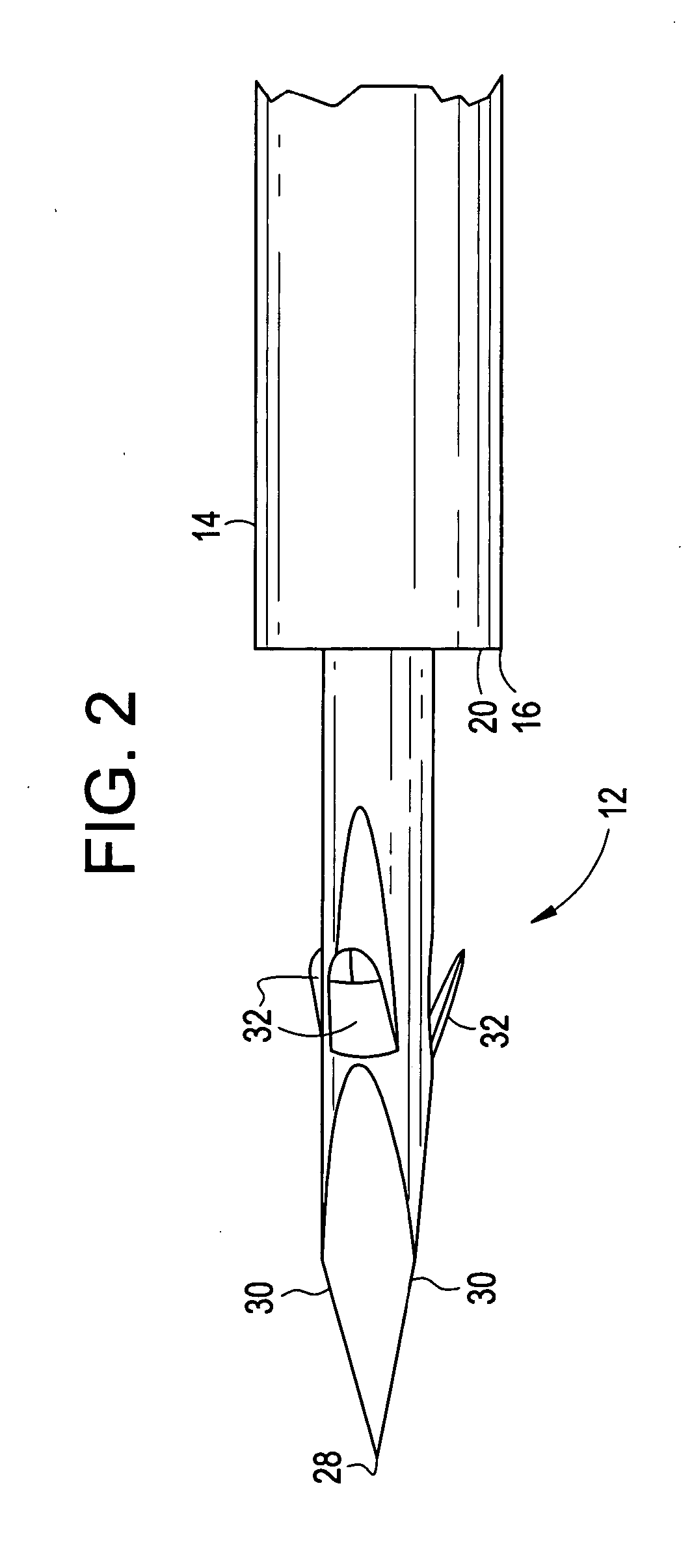 Tissue punch and method for creating an anastomosis for locating a bypass graft