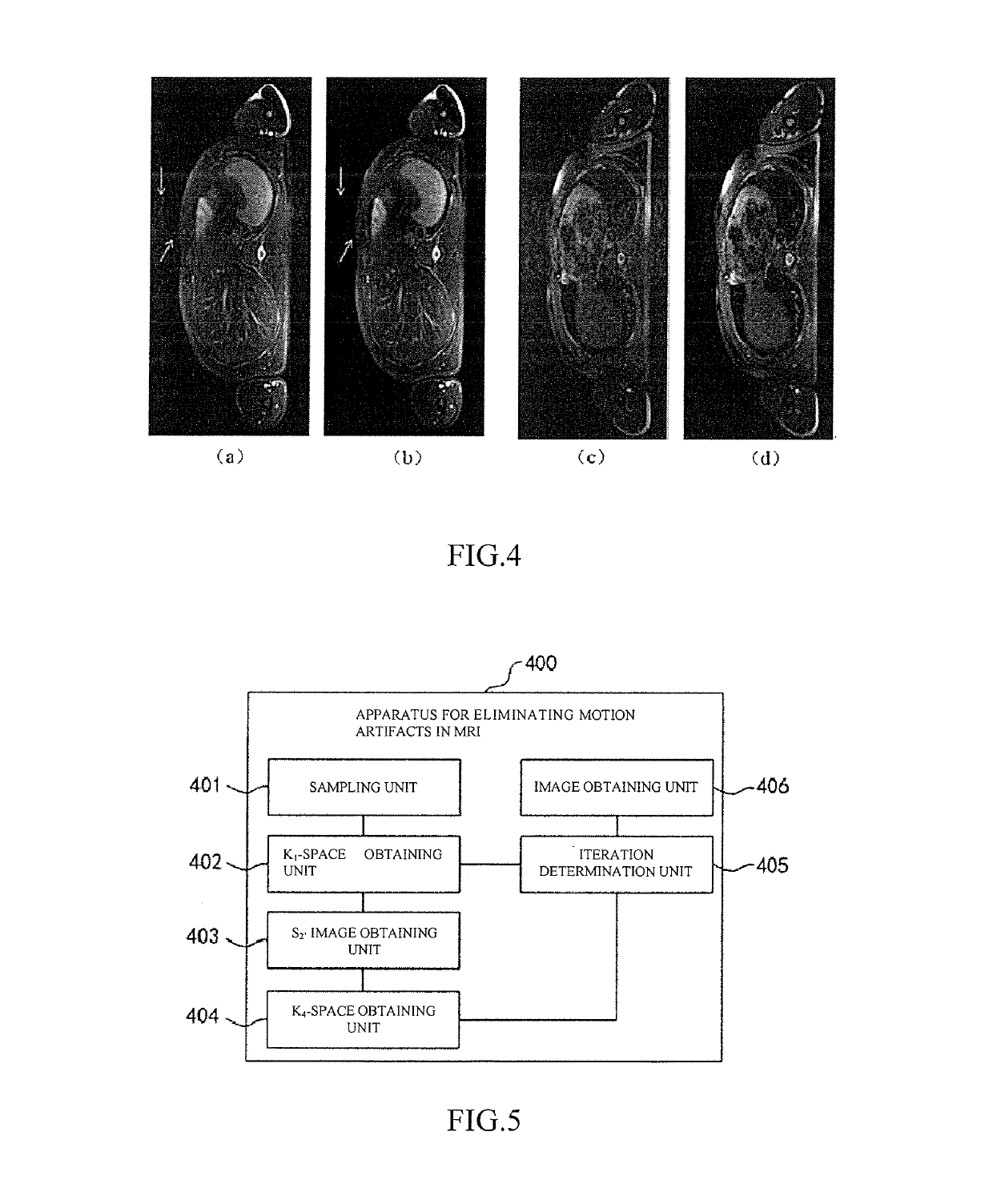 Method and apparatus for eliminating motion artifact in magnetic resonance imaging