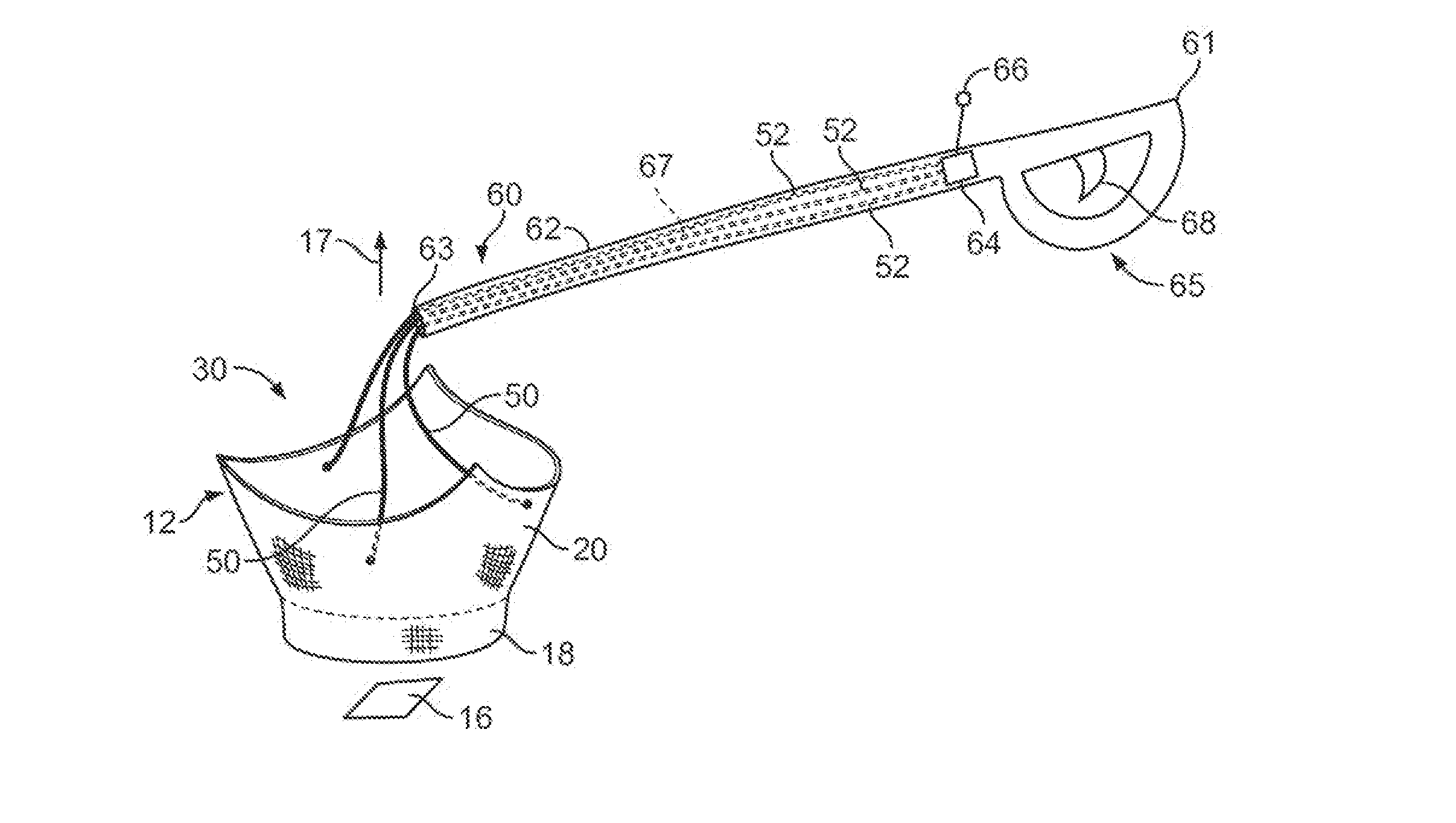 Multiple Component Prosthetic Heart Valve Assemblies and Methods for Delivering Them