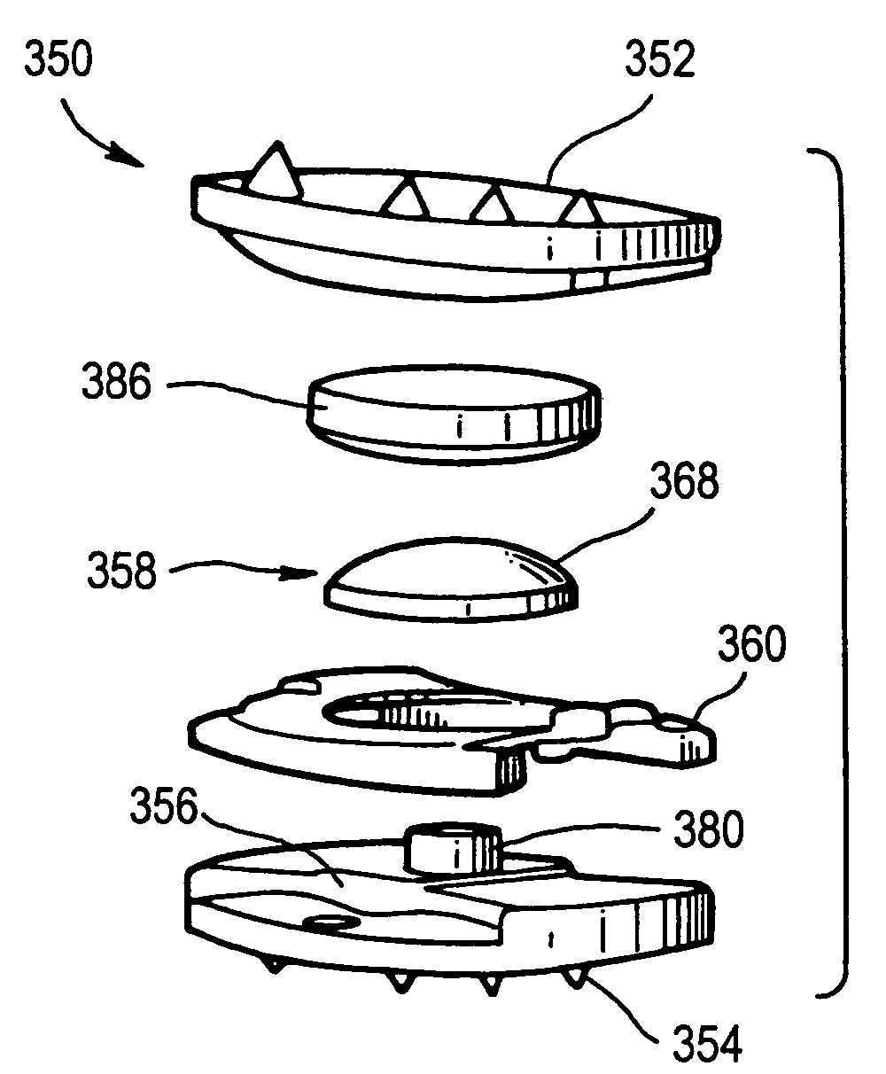 Controlled artificial intervertebral disc implant
