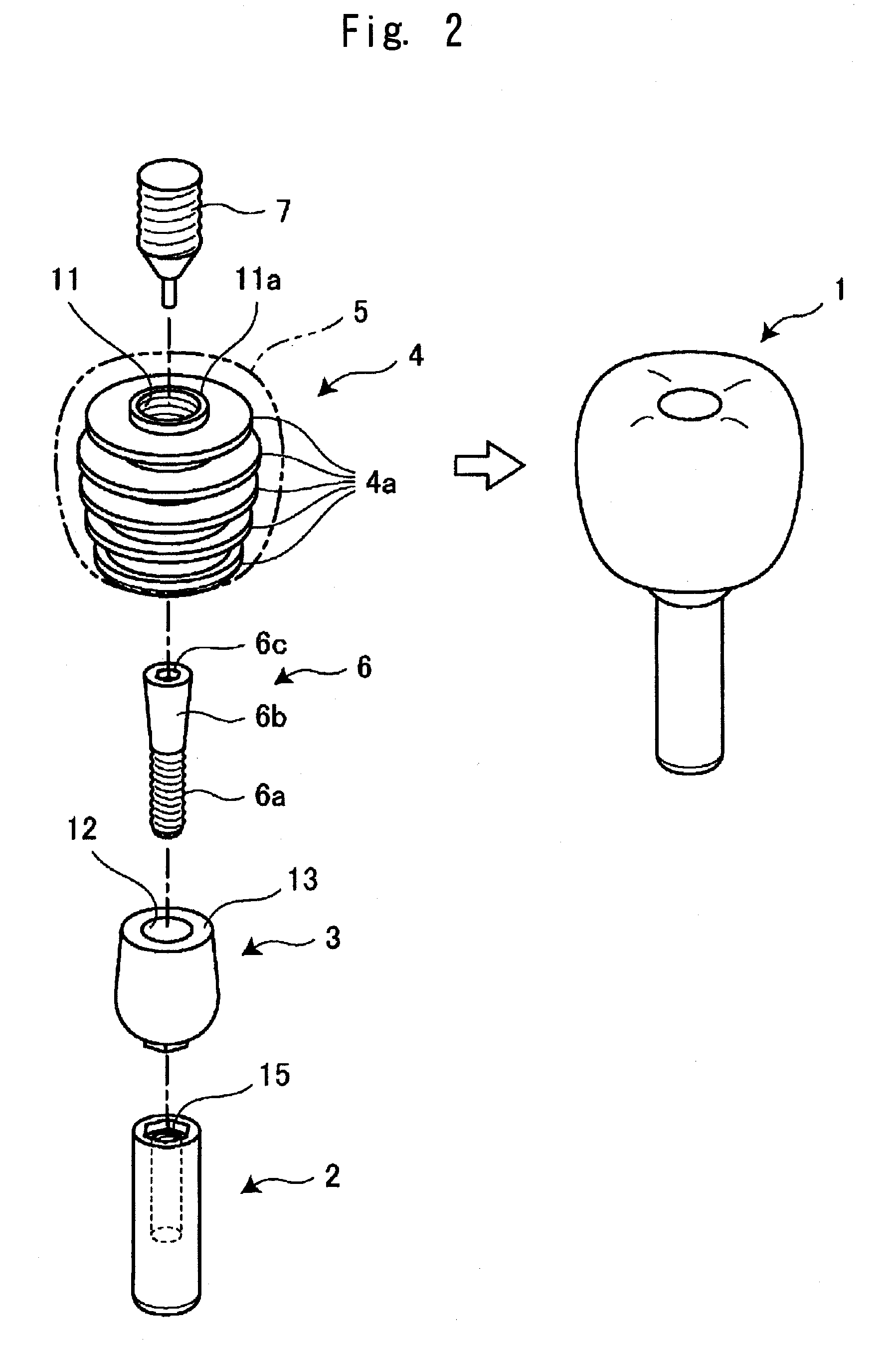 Human body implant structure, method of assembling the structure and method of disassembling the structure