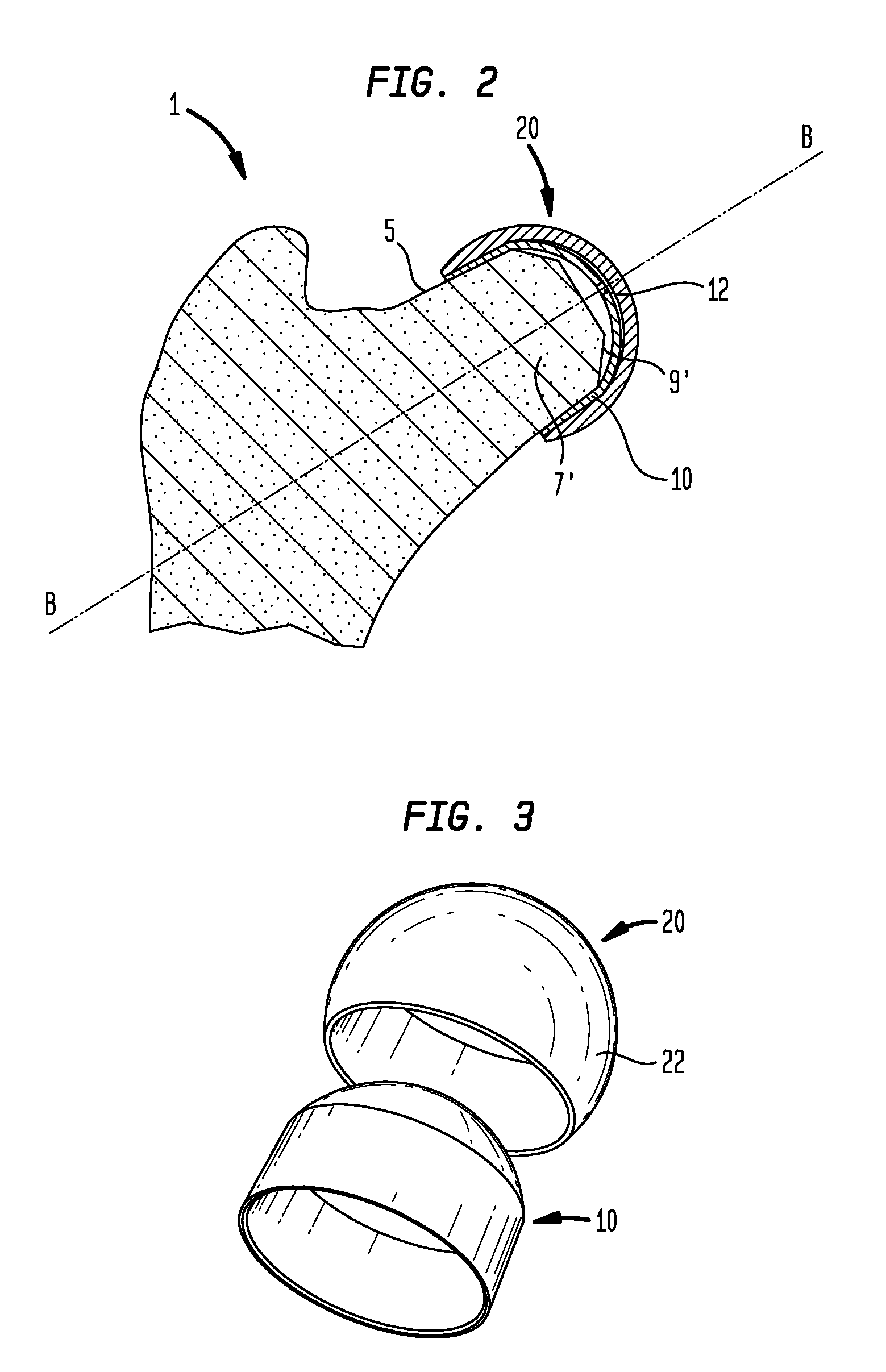 Method and apparatus for hip femoral resurfacing tooling