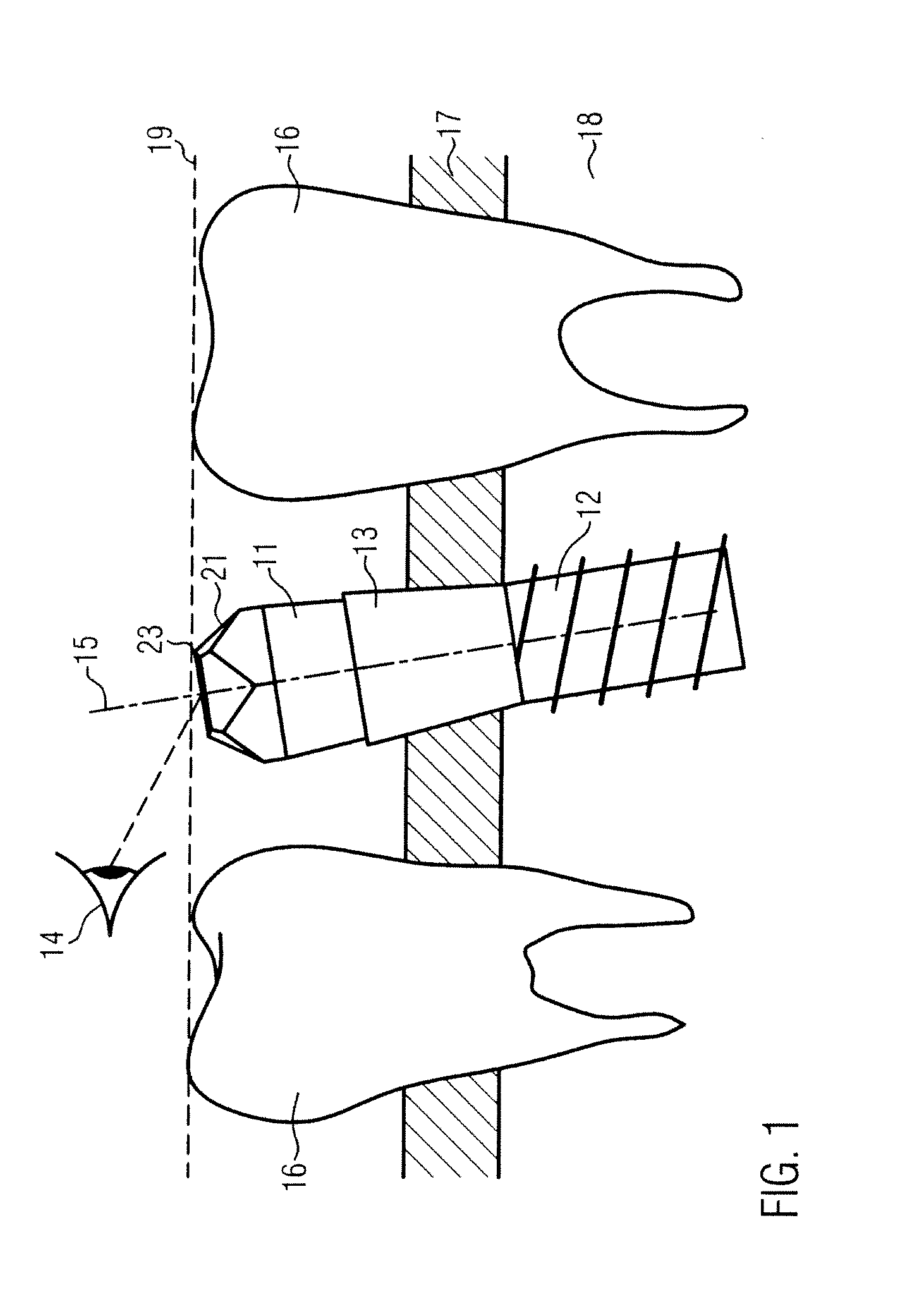 Determining position and orientation of a dental implant