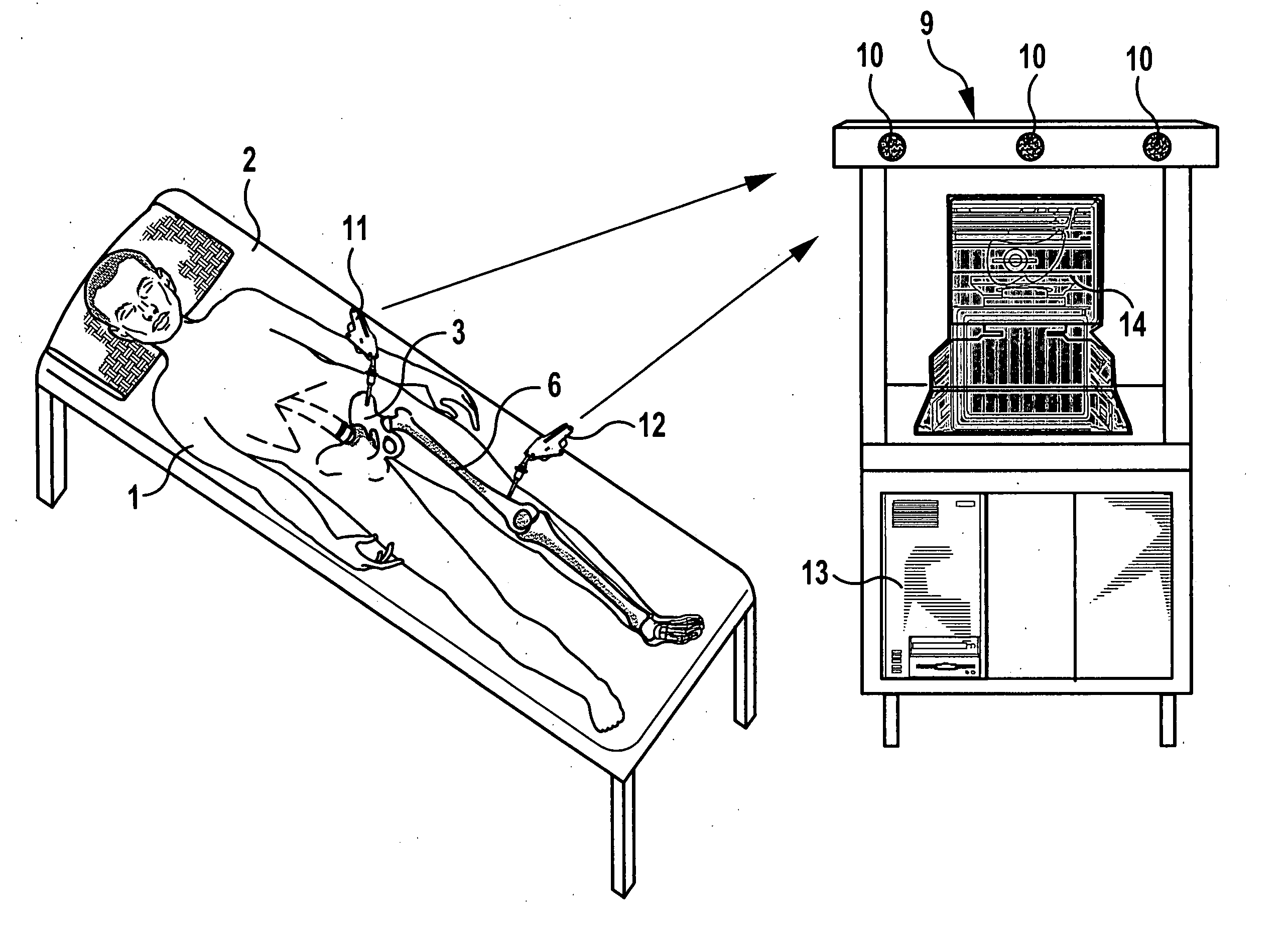 Method and device for determination of the mobility of a hip joint prosthesis