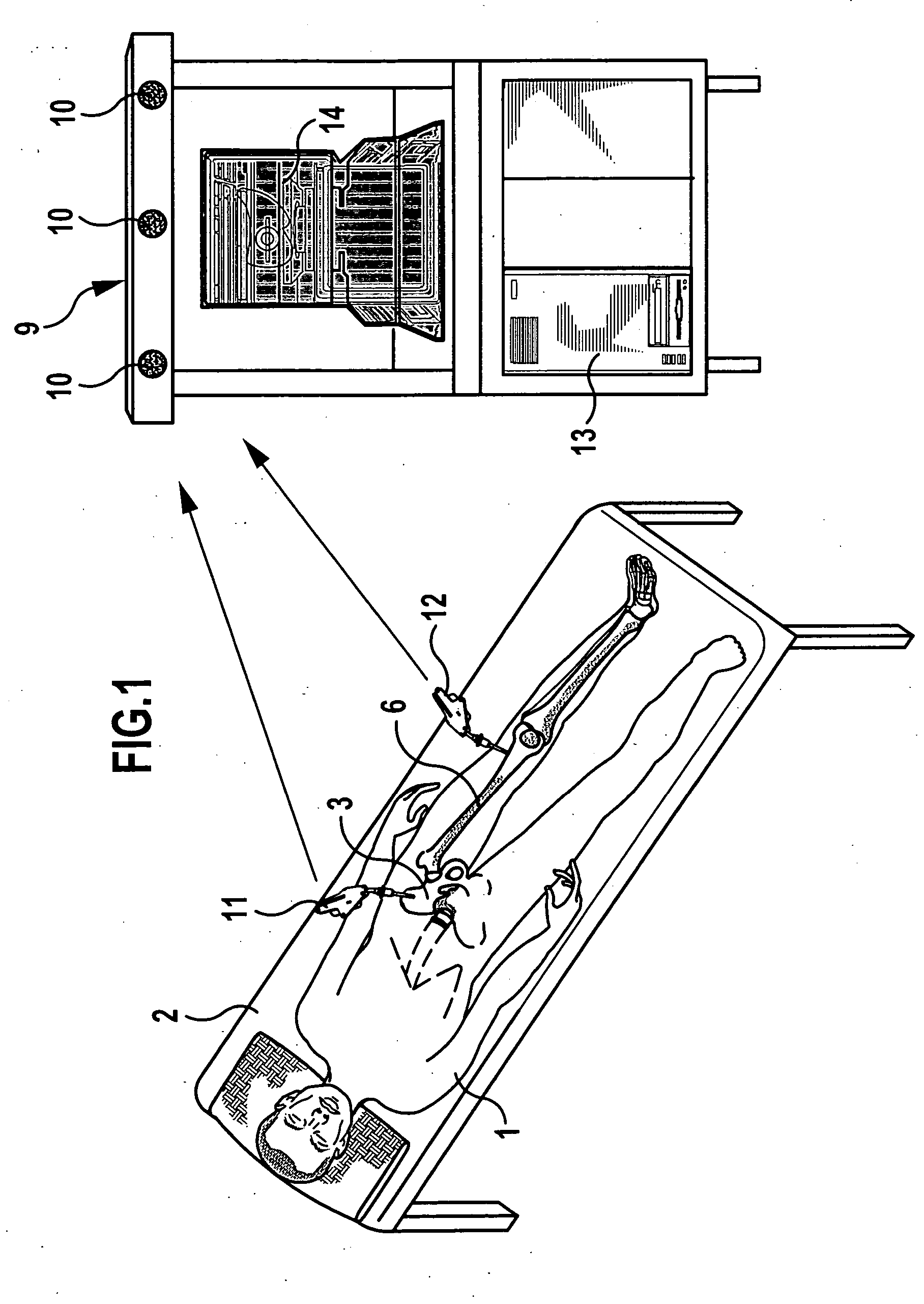 Method and device for determination of the mobility of a hip joint prosthesis