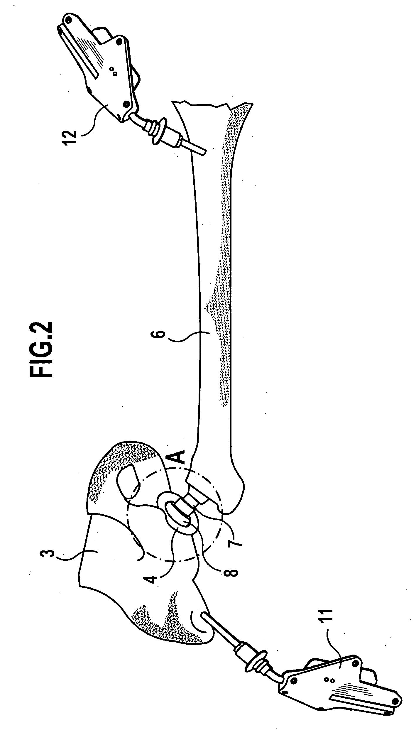 Method and device for determination of the mobility of a hip joint prosthesis