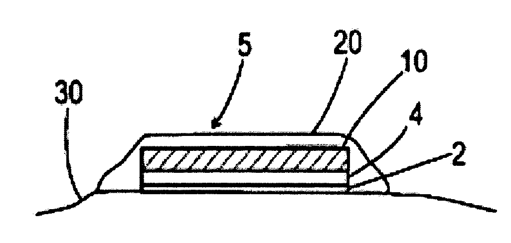 Drug-delivery patch comprising a dissolvable layer and uses thereof