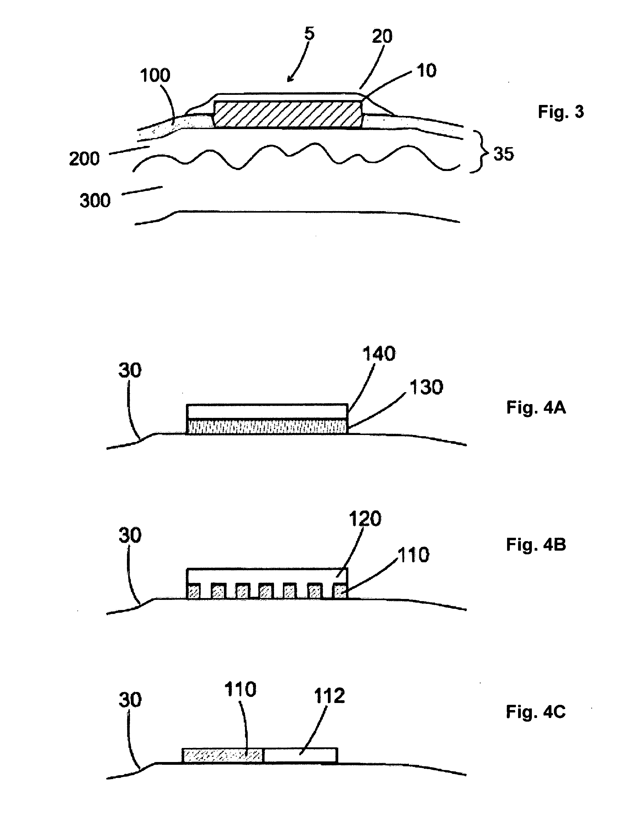 Drug-delivery patch comprising a dissolvable layer and uses thereof