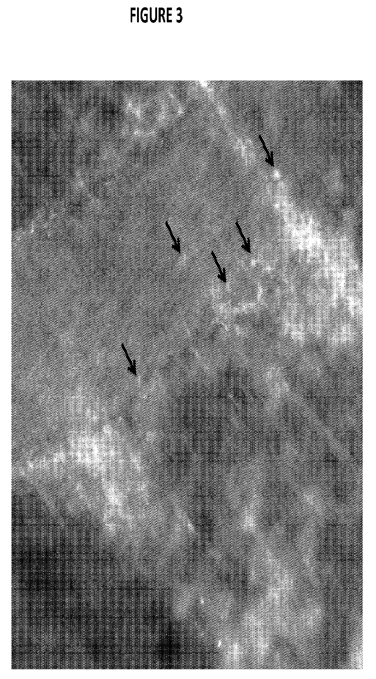 Carbon Nanotubes for Imaging and Drug Delivery