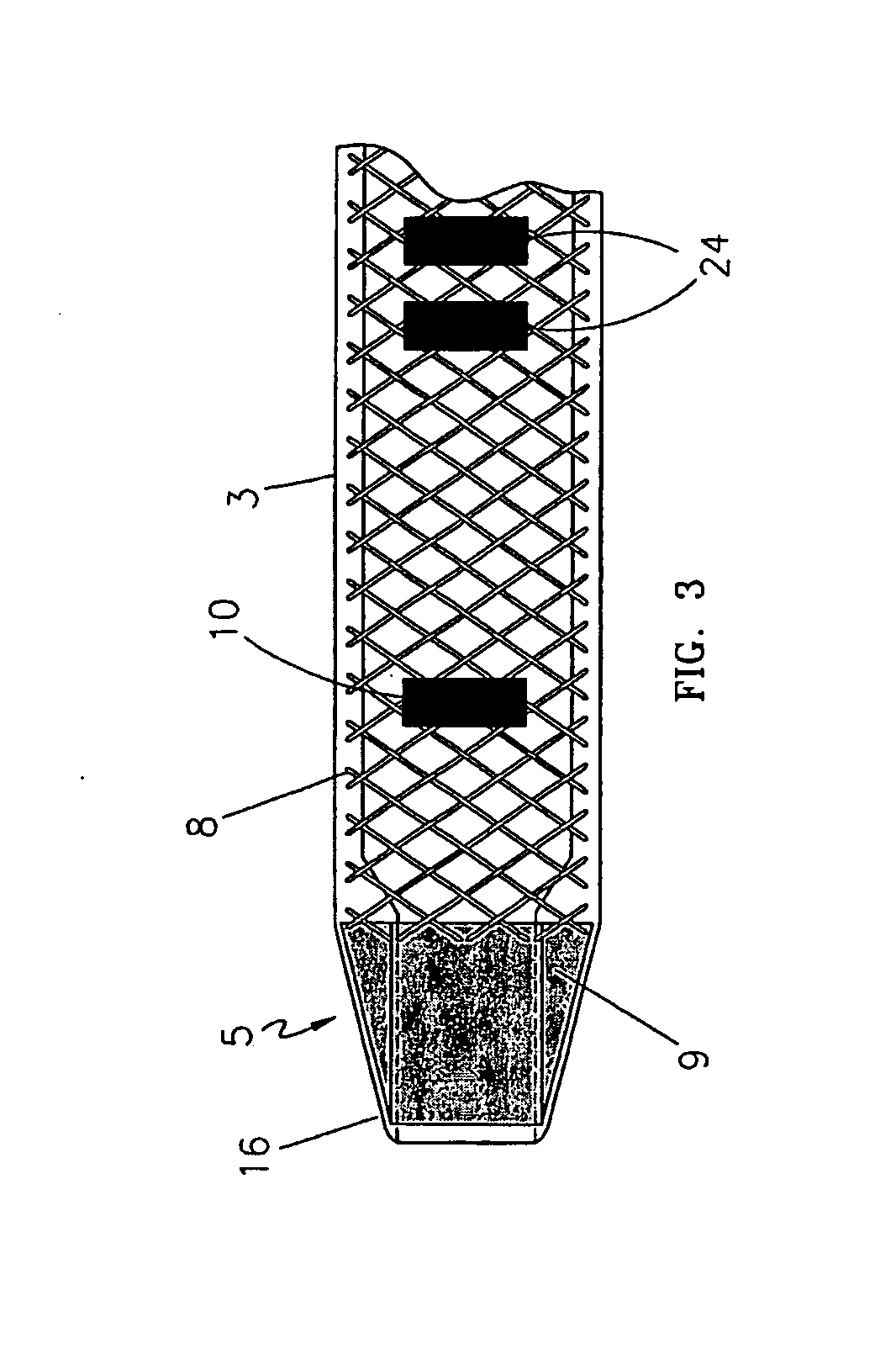 Endovascular treatment apparatus and method