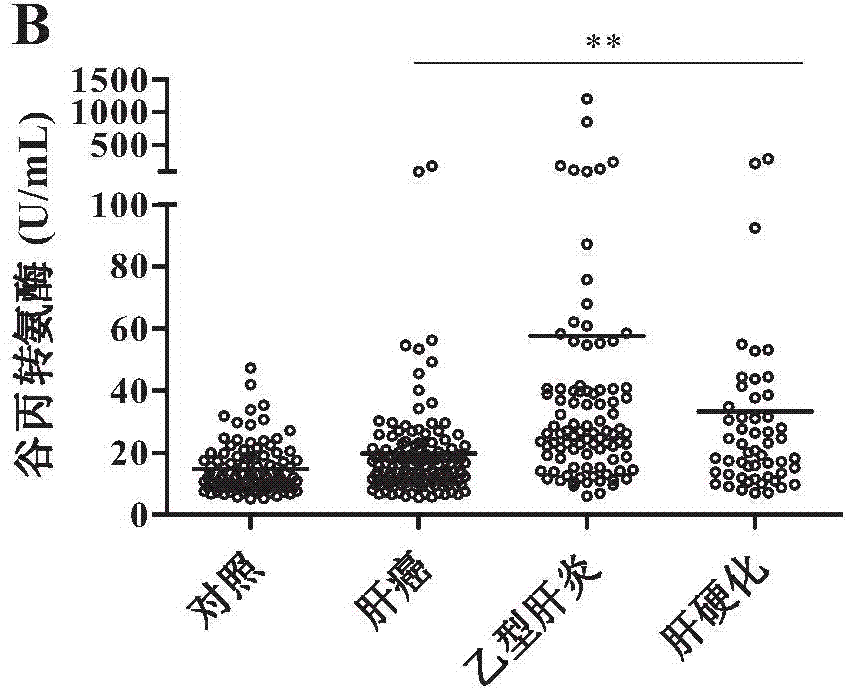 Method for diagnosing liver disease by utilizing property of serum capable of oxidizing sulfhydryls and kit