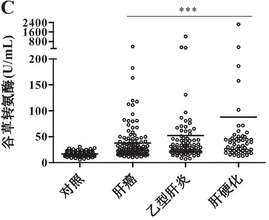 Method for diagnosing liver disease by utilizing property of serum capable of oxidizing sulfhydryls and kit