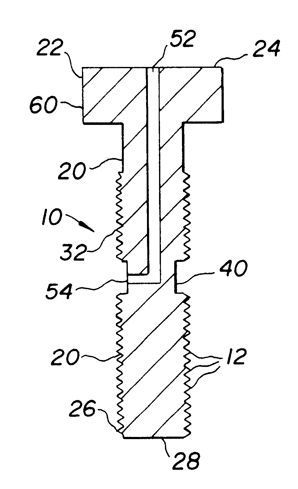 Sealable fastener with sealant delivery passageway to circumferential sealant channel
