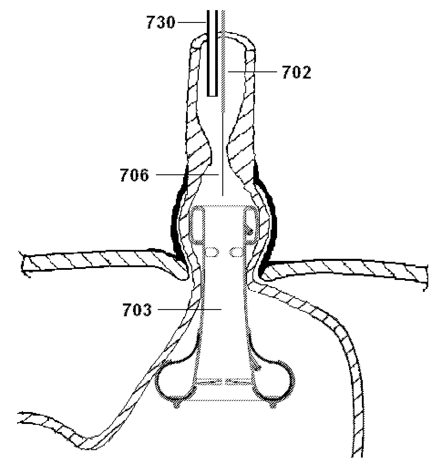 Anti-reflux devices and methods for treating gastro-esophageal reflux disease (GERD)