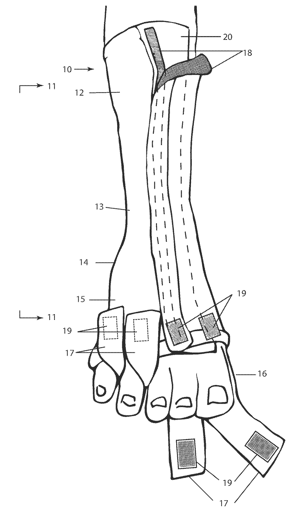 Open Front Pedicure Sock