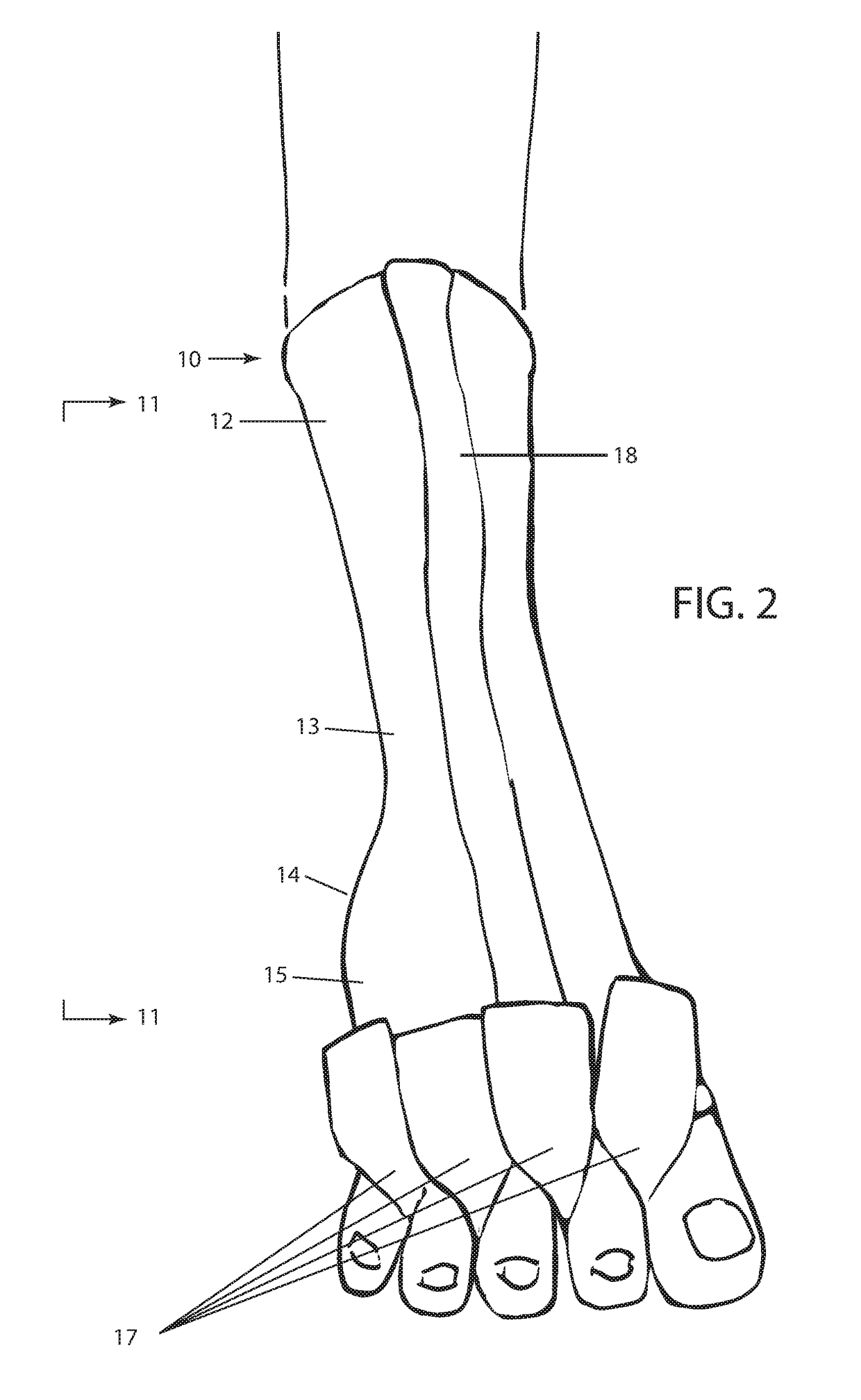 Open Front Pedicure Sock