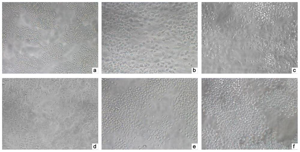 Application of a kind of Mauritian patriline in the preparation of choleretic drugs