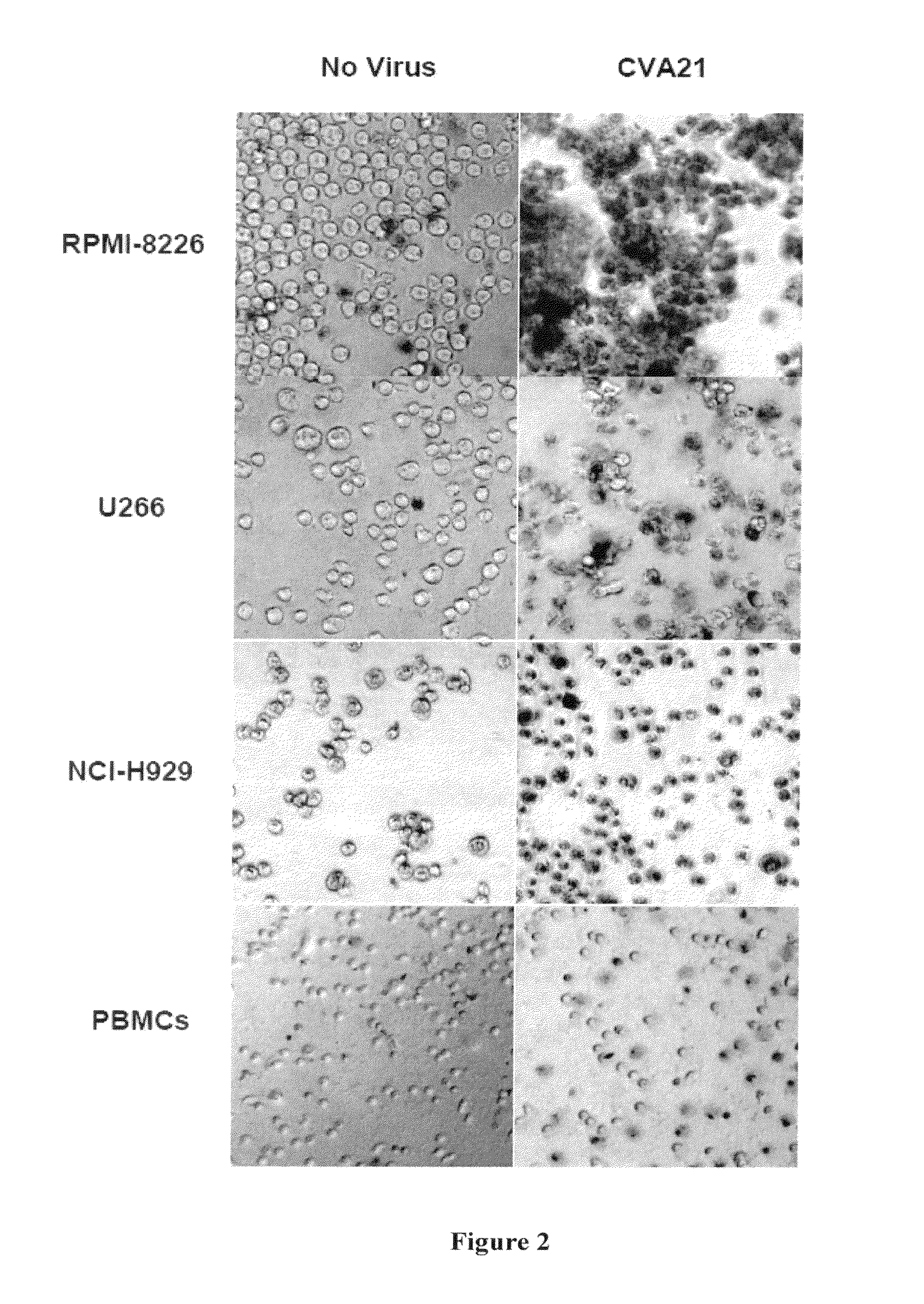 Methods and compositions for treatment of hematologic cancers