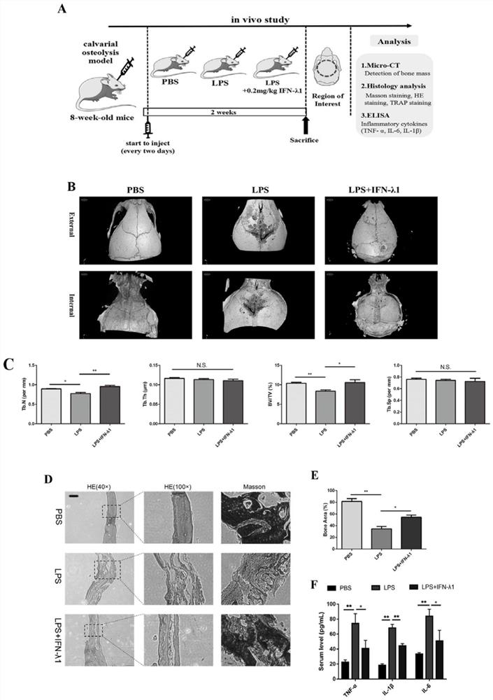 Application of recombinant ifn-λ1 protein in the preparation of drugs for preventing and treating inflammatory bone loss