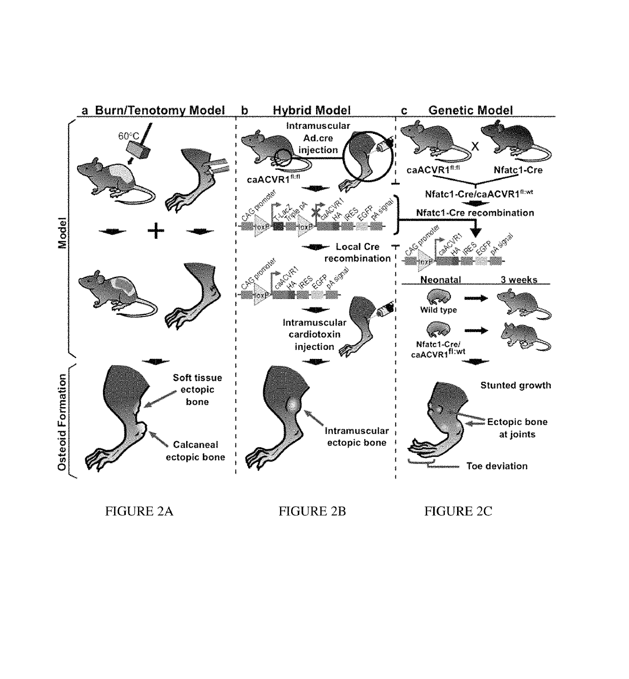 Method of treating heterotopic ossification