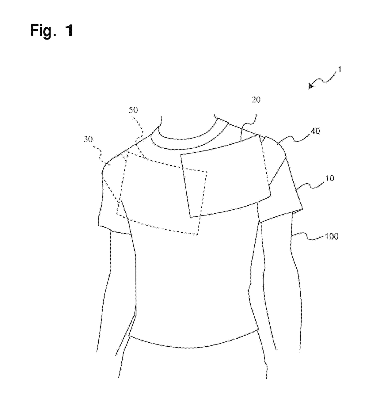 Shirt for correcting bone alignment