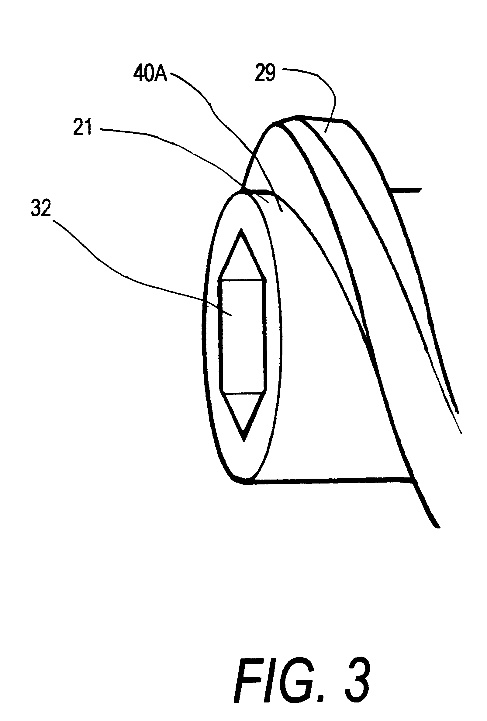 Offset helix surgical fixation screws and methods of use