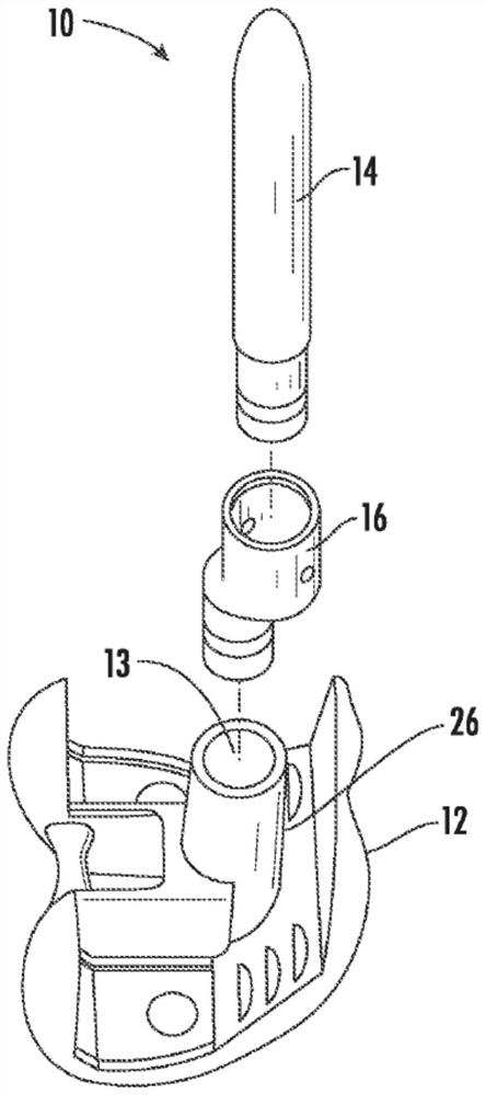 Orthopedic implant