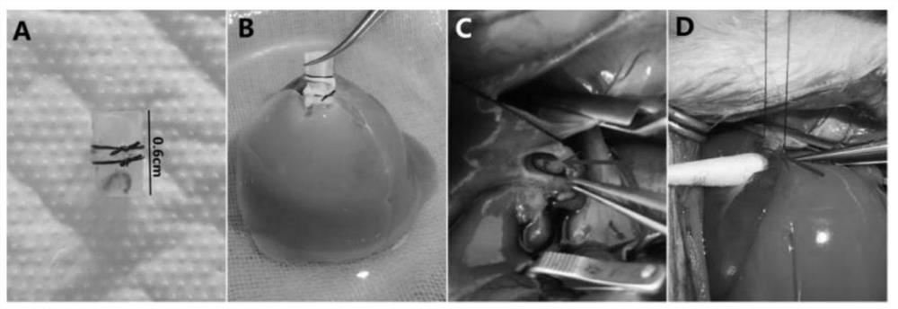 Improved intravenous lining stent rat orthotopic liver transplantation model establishing method