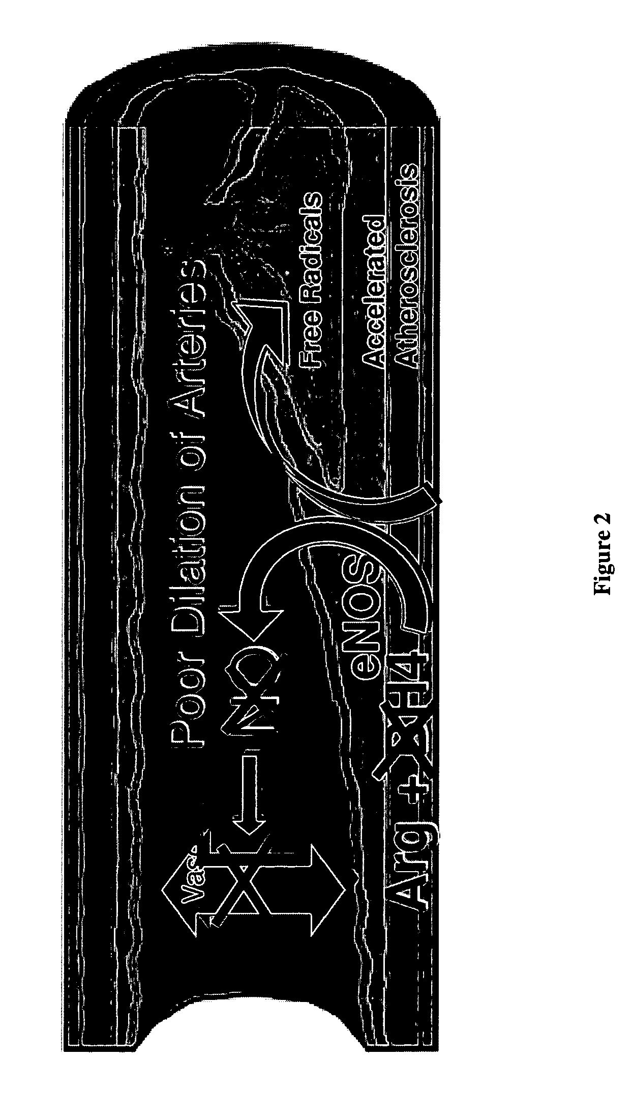 Methods and compositions for the treatment of vascular disease