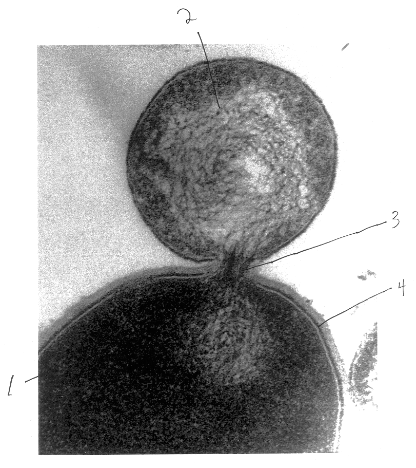 Composition for treatment of an ocular bacterial infection