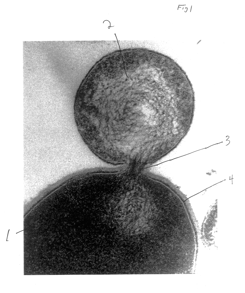 Composition for treatment of an ocular bacterial infection