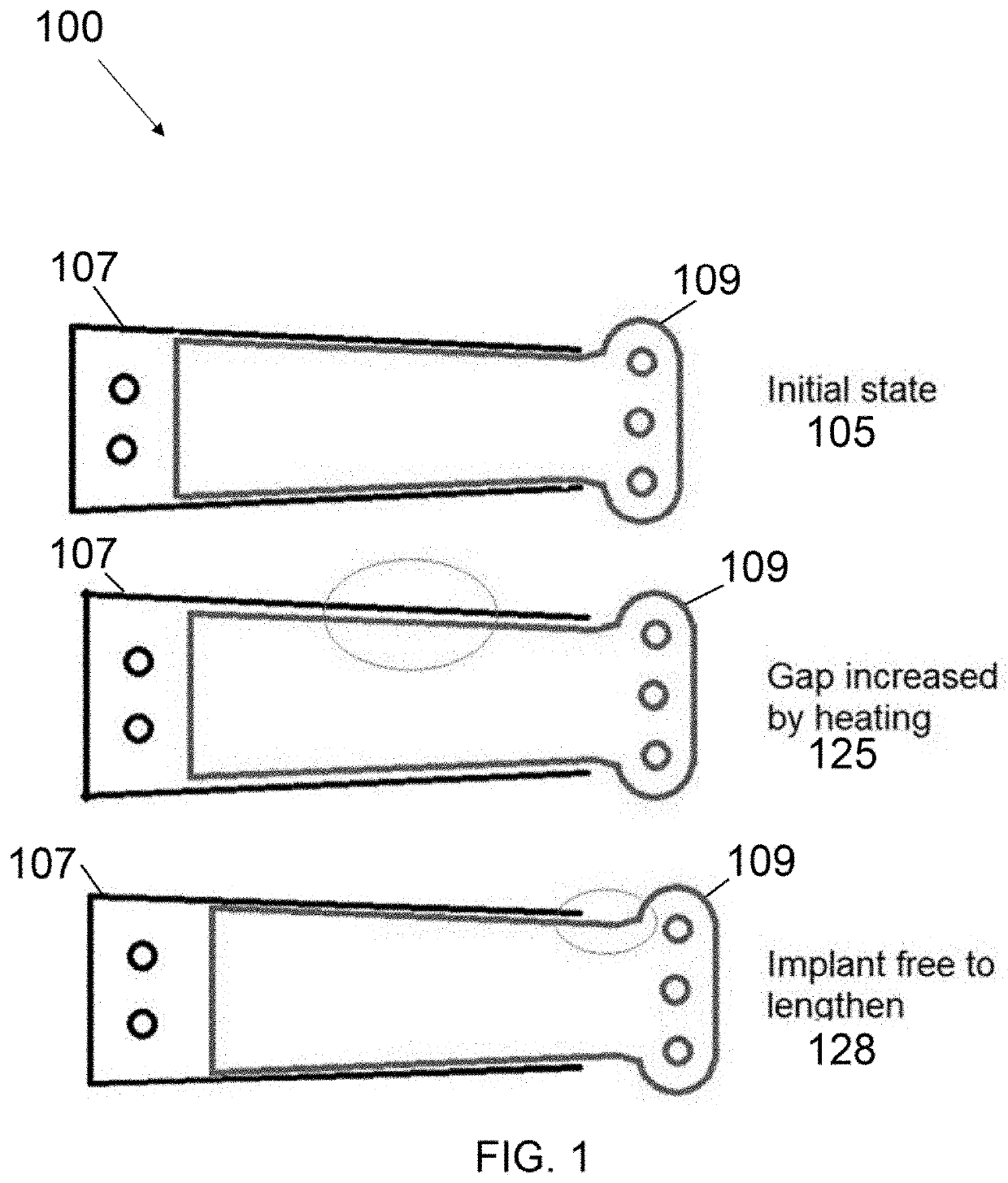 Metal plate with one-way shape memory effect