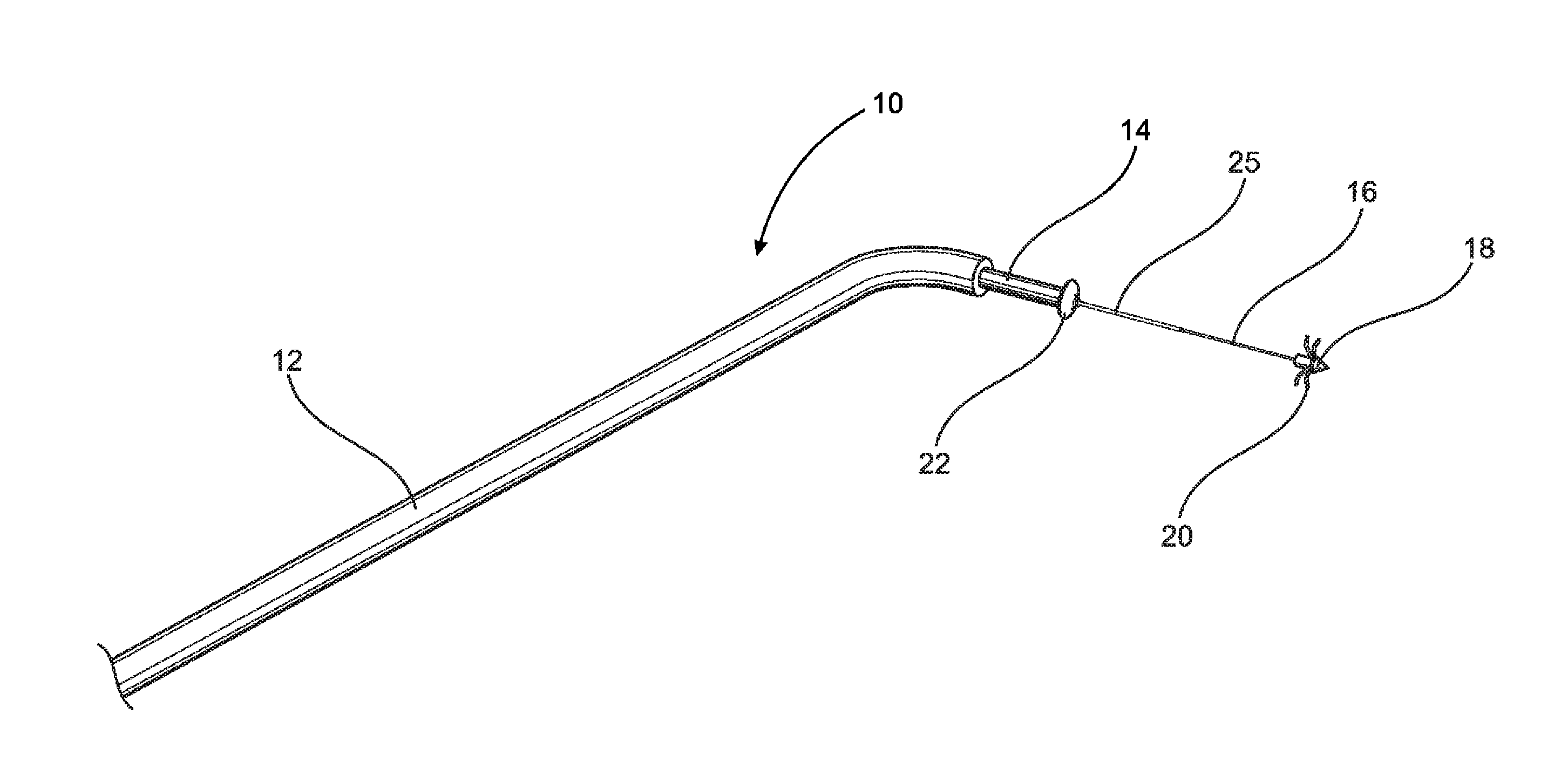 Device and method of treating heart valve malfunction