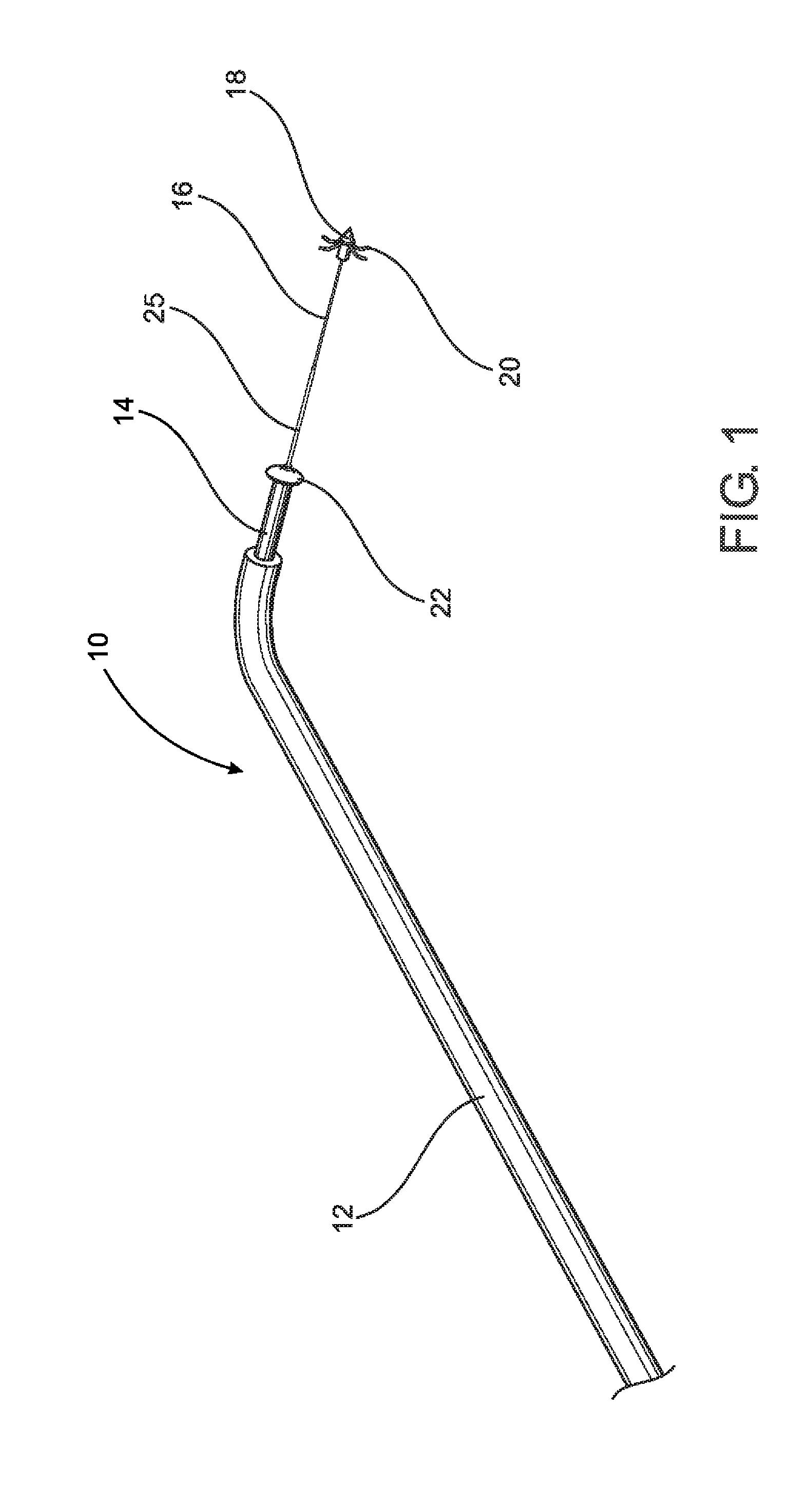 Device and method of treating heart valve malfunction