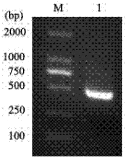 A kind of recombinant trail protein and its preparation method and application