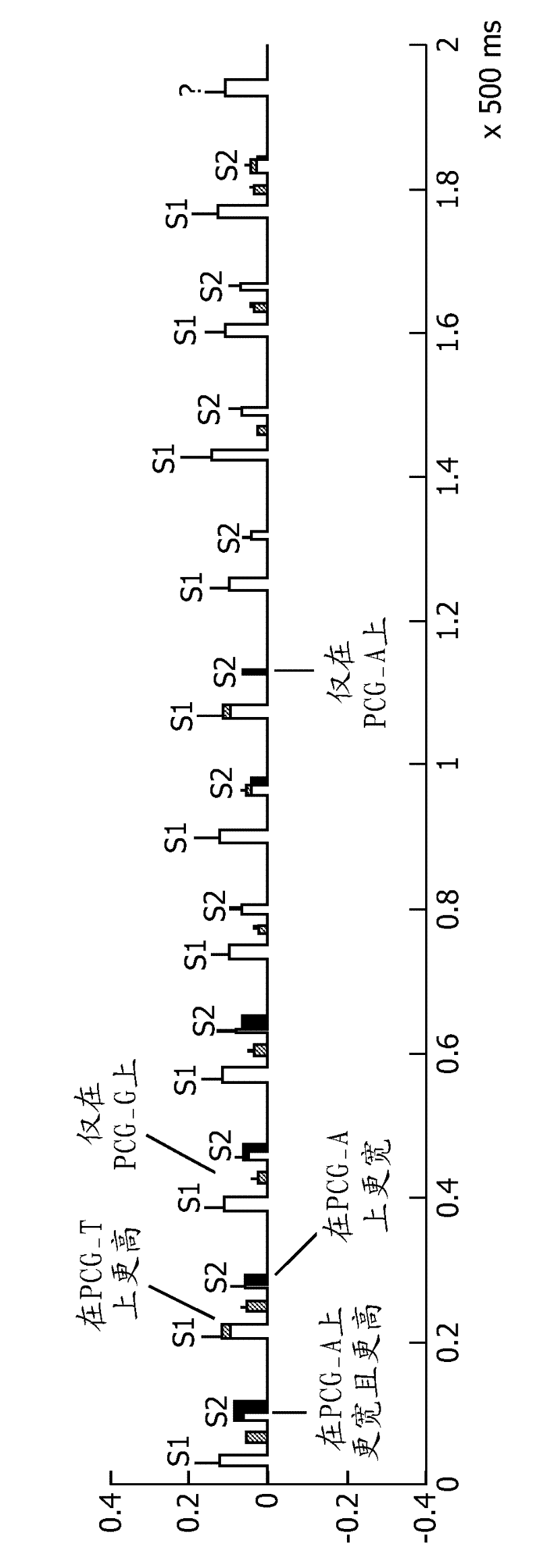 Method and system for processing heart sound signals