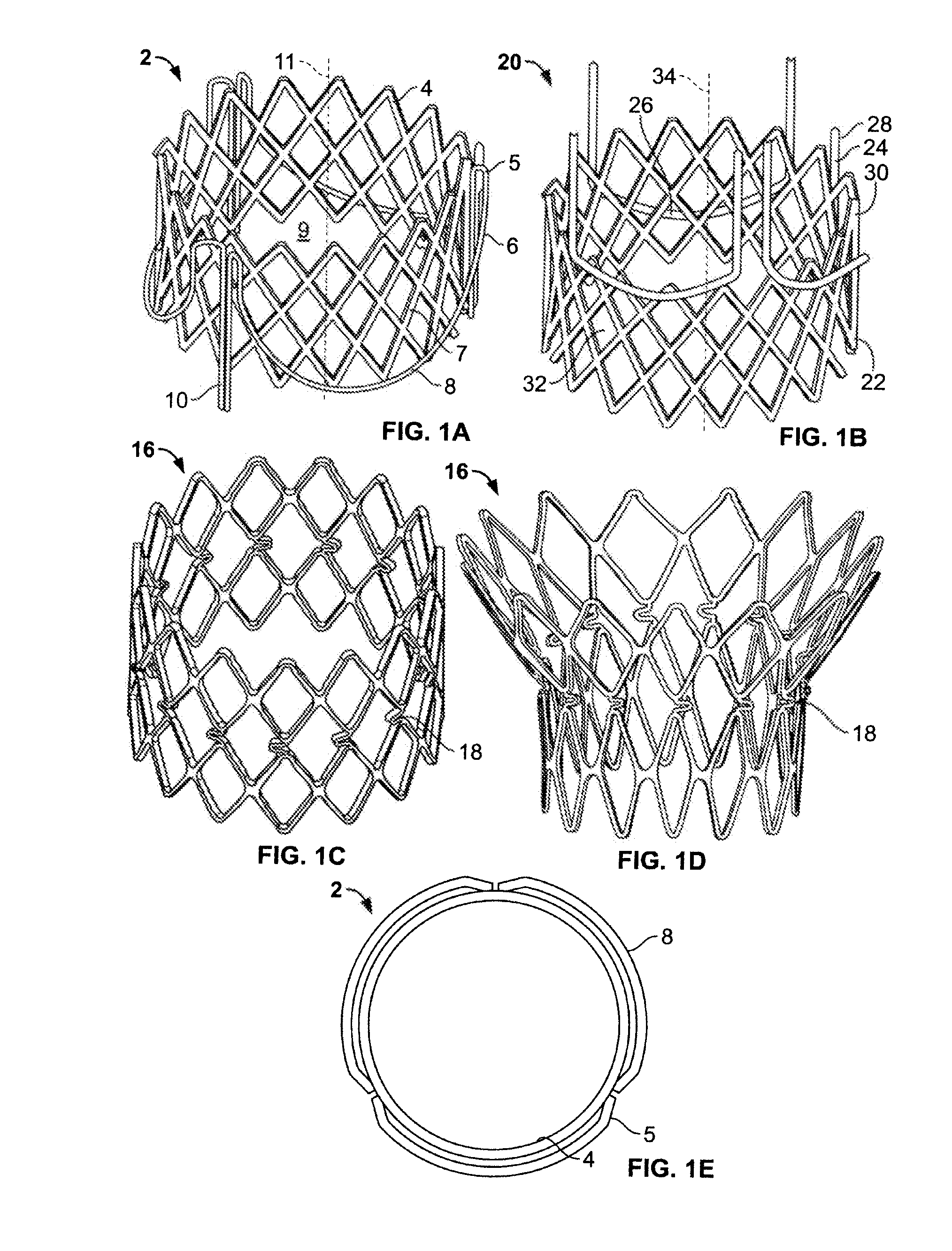 Methods for Delivery of a Sutureless Pulmonary or Mitral Valve