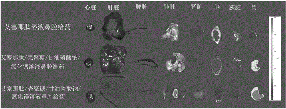 Exenatide nasal drug delivery preparation and preparation method thereof