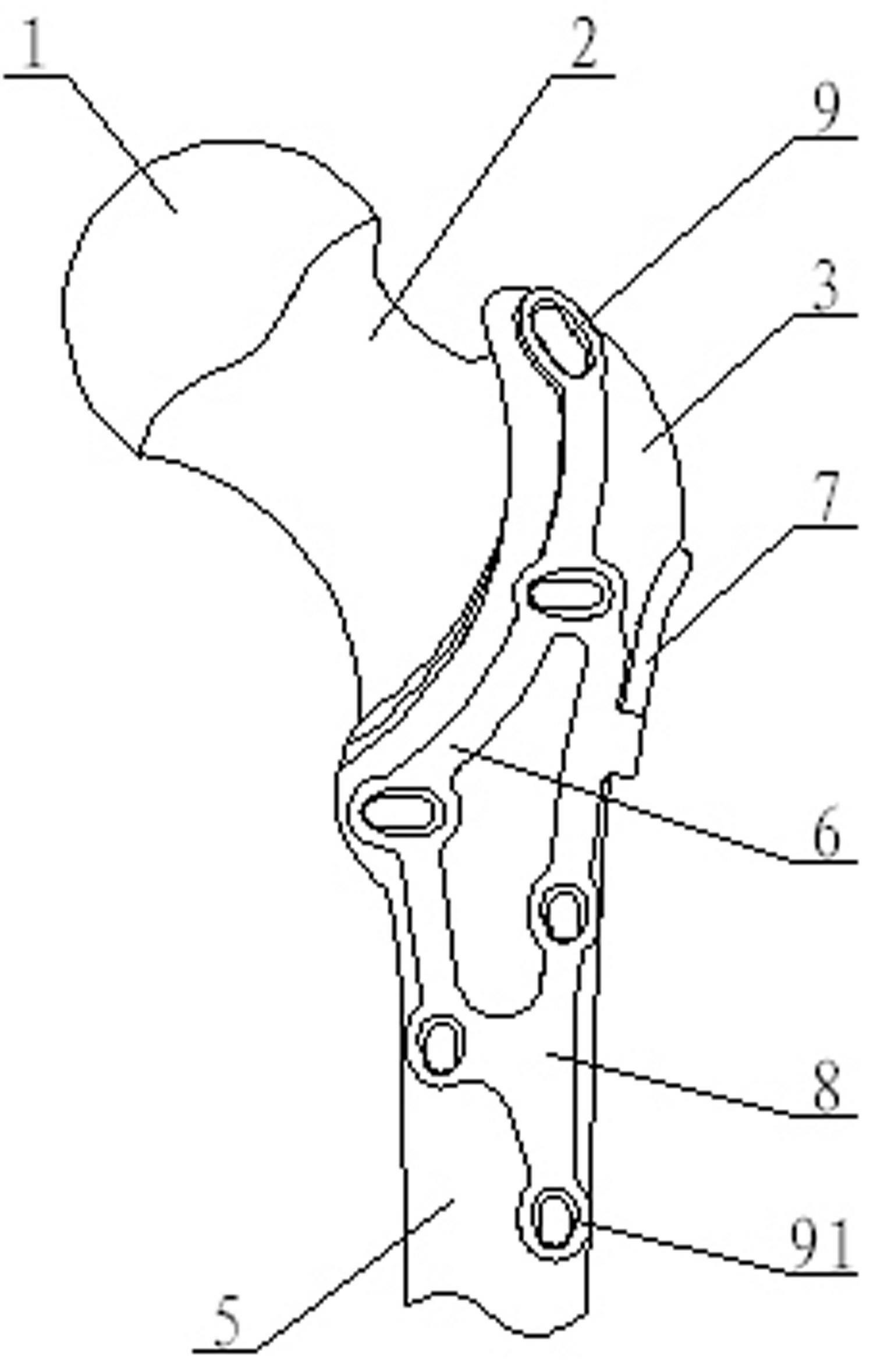 Minimal invasive combined pressurizing and locking bone fracture plate for trochanter comminuted fracture and femoral neck fracture
