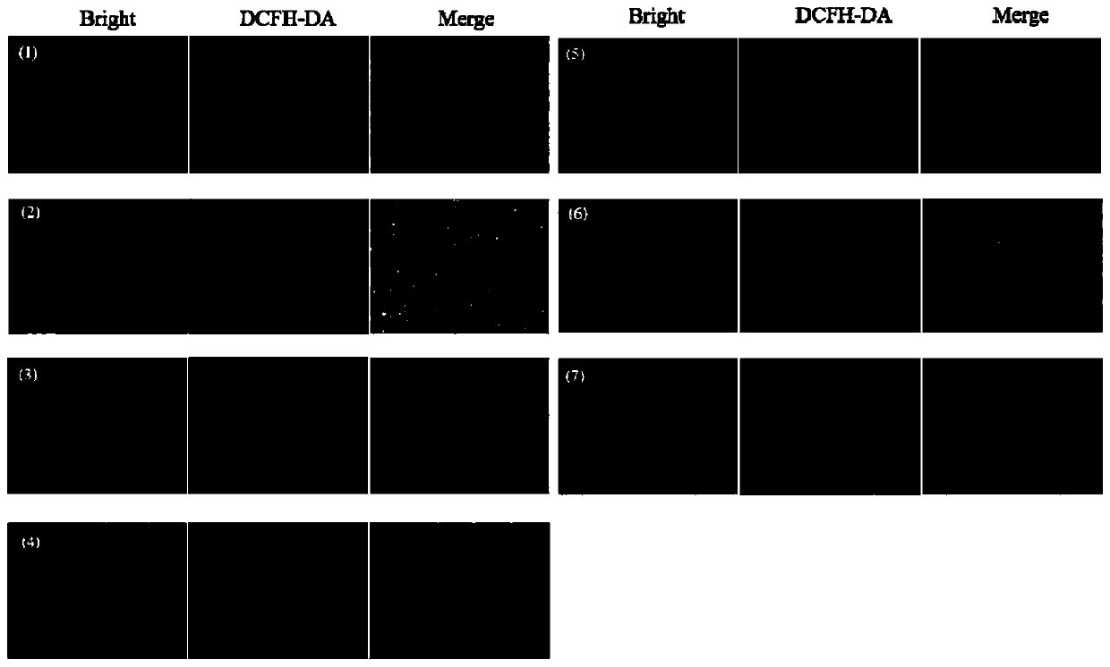 Preparation method of breast milk-based wound dressing and application thereof