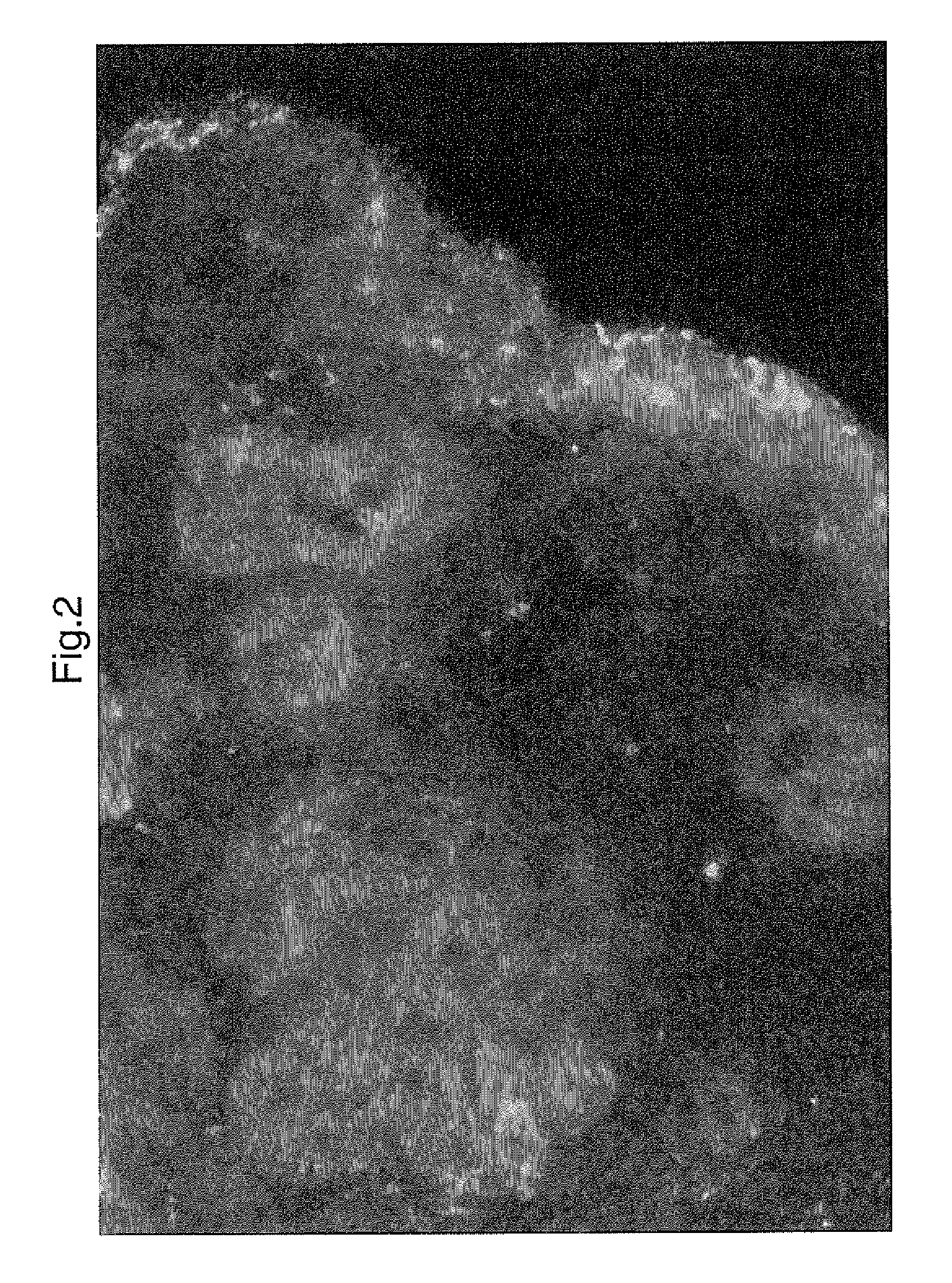Compounds for the selective treatment of the intestinal immuno-inflammatory component of the celiac disease