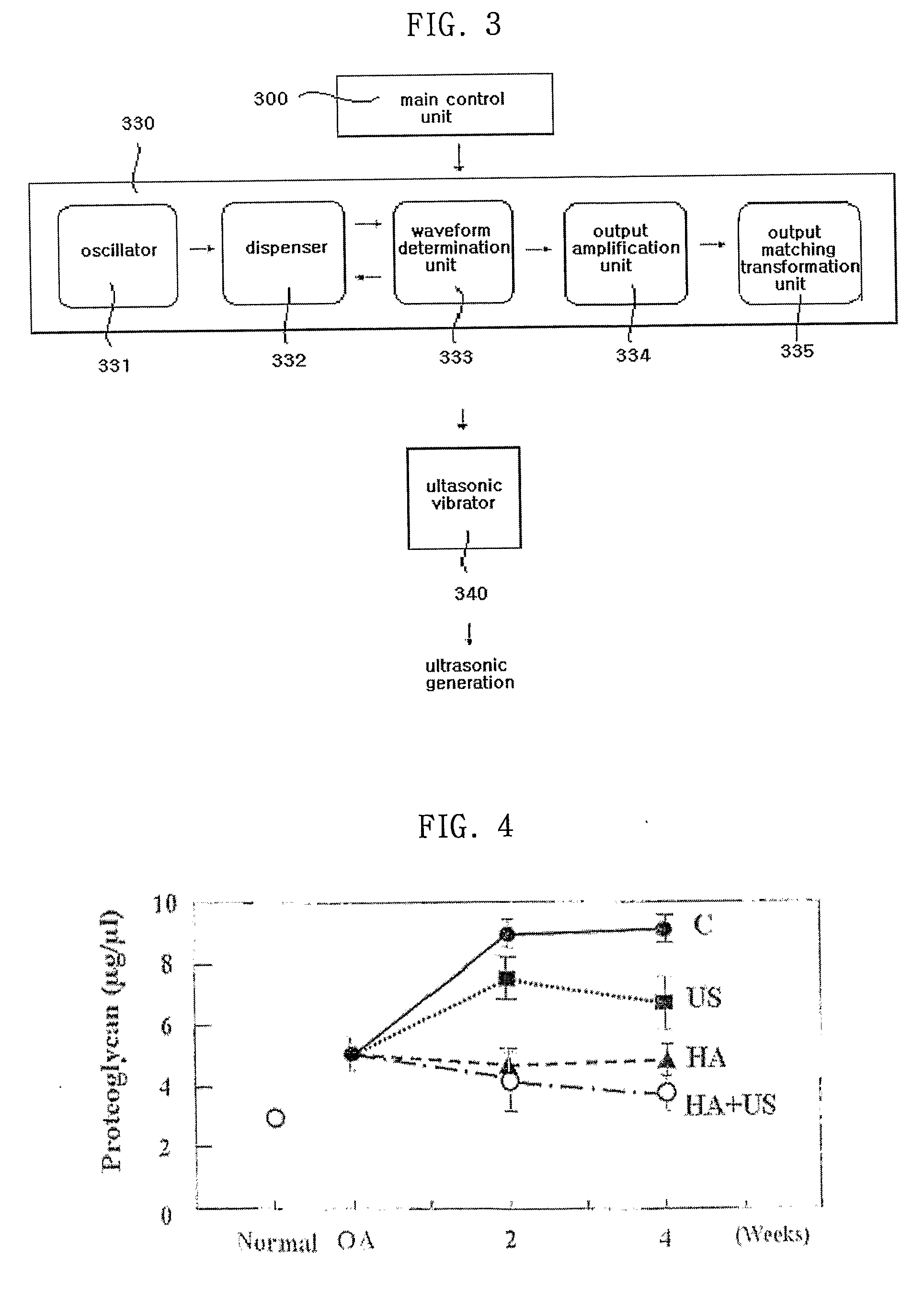 Ultrasonic Equipment for Treatment of Osteoarthritis