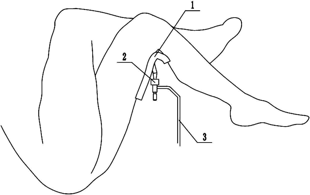 Posture fixing frame used in enteroscopy and colonoscopy