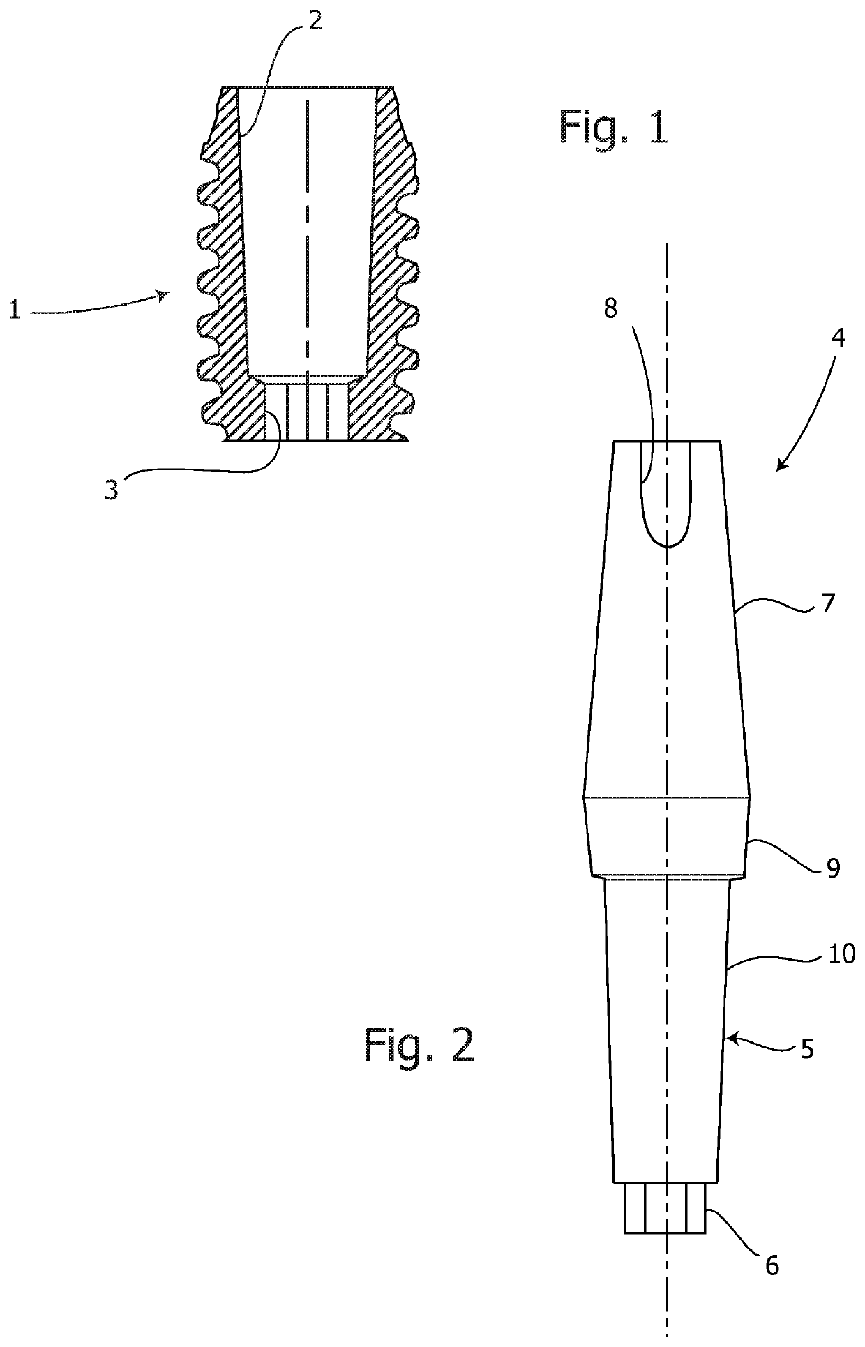 Dental implant system