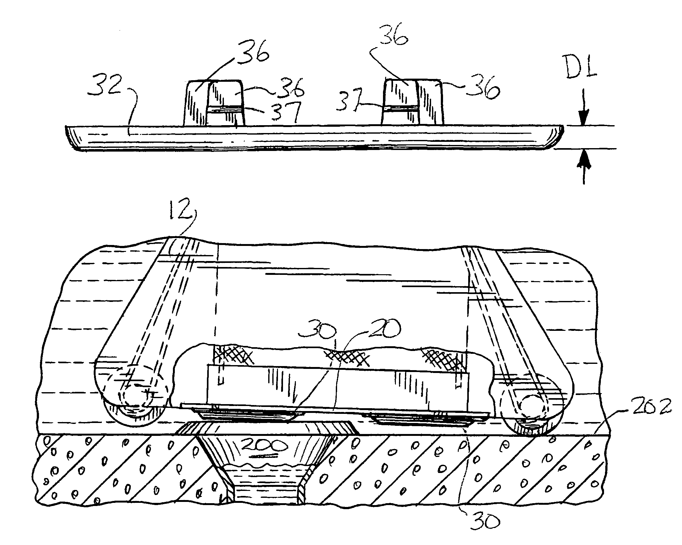 Pool cleaner baseplate with inlet extension members and recessed wheels